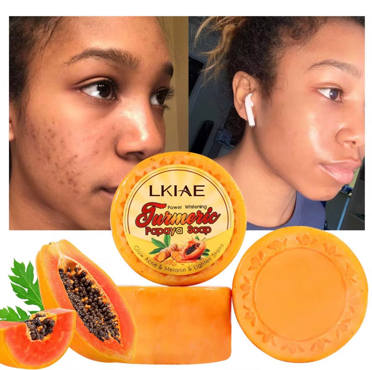 Turmeric & Papaya Soap 2 pack set 

Reveal Your Natural Glow! Acne removal