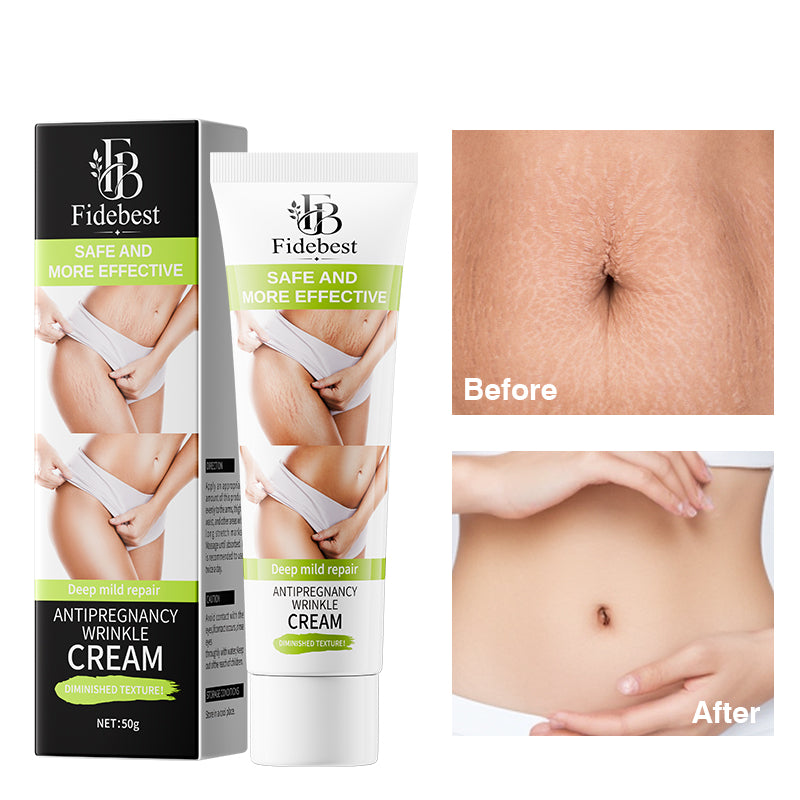 Anti pregnancy wrinkle cream , reduce stretch fat line , stretch mark repair, scar removal cream