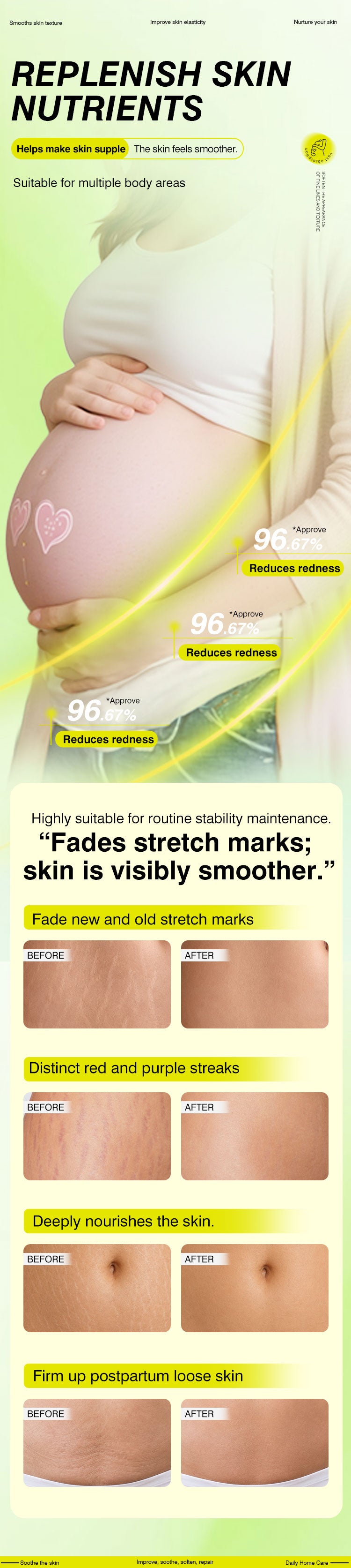 Anti pregnancy wrinkle cream , reduce stretch fat line , stretch mark repair, scar removal cream