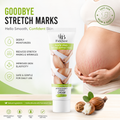 Anti pregnancy wrinkle cream , reduce stretch fat line , stretch mark repair, scar removal cream